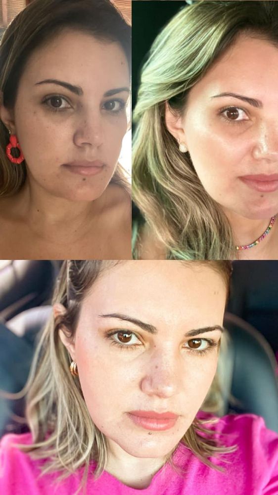 Skin Booster